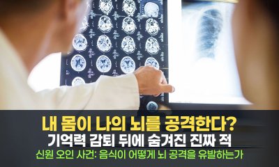 내 몸이 나의 뇌를 공격한다? 기억력 감퇴 뒤에 숨겨진 진짜 적, 자가면역